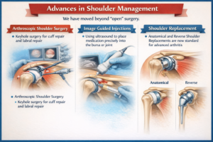 Advances in Shoulder Management