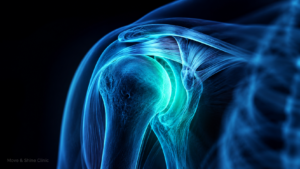 Shoulder Pain Causes and Treatment: Complete Orthopedic Guide 1 Physiotherapist demonstrating shoulder pain treatment techniques — professional orthopedic care at Move & Shine Clinic Bangalore